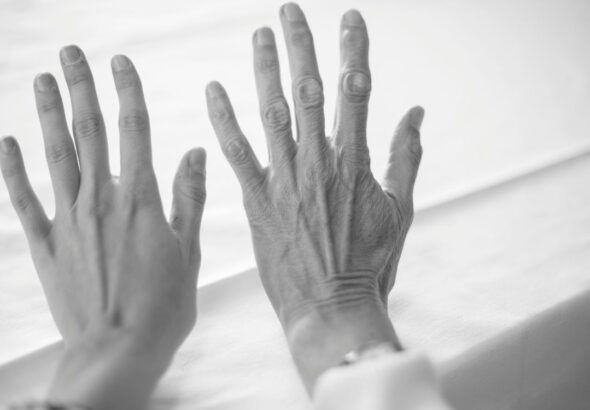 parkinson-ayahuasca-tratamiento-sin-alucionaciones