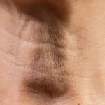 cuello