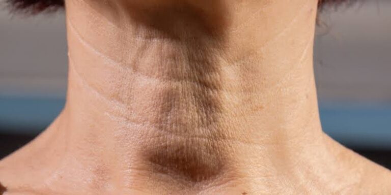 cuello